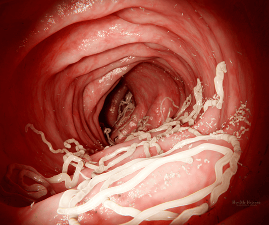 What Are Parasites — and Why Gut Balance Matters